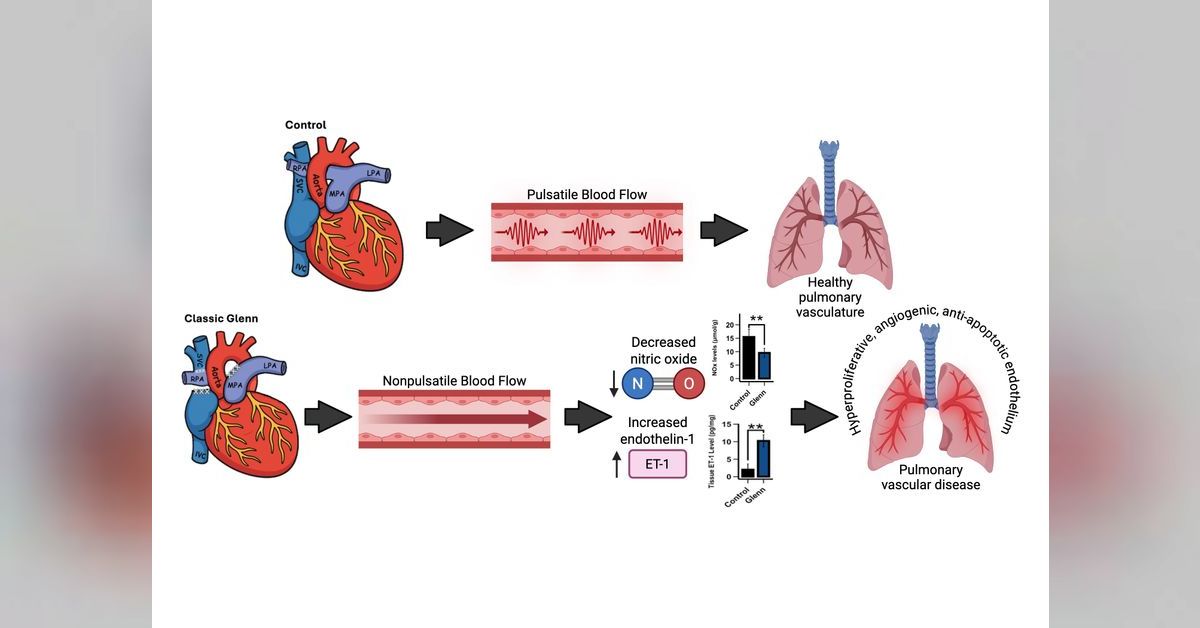 Interorgan Insights: Pulmonary Vascular Endothelial Cell Dysfunction ...