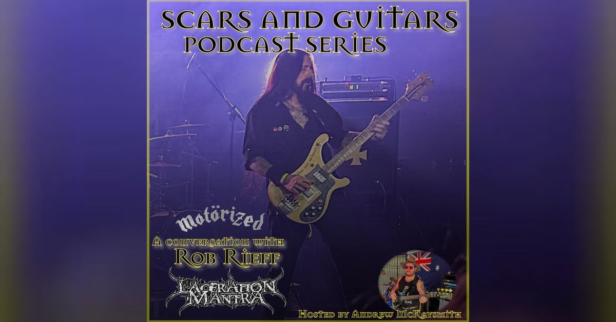Rob Rieff (Laceration Mantra/ Motorized) | Scars and Guitars